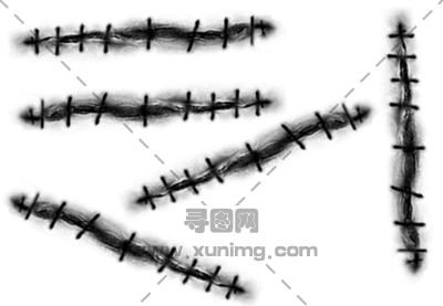 伤疤pNG免抠图片|分辨率:400×277预览图